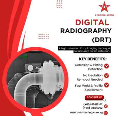 Digital Radiography in singapore